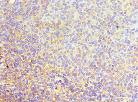 Immunohistochemistry of paraffin-embedded human tonsil tissue using SRSF4 Antibody at dilution of 1:100Rabbit anti-Human SRSF4 Polyclonal Antibody