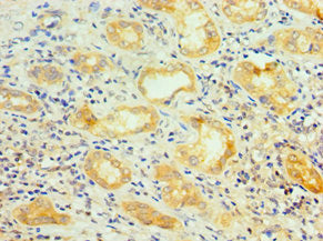 Immunohistochemistry of paraffin-embedded human kidney tissue using SRSF4 Antibody at dilution of 1:100Rabbit anti-Human SRSF4 Polyclonal Antibody