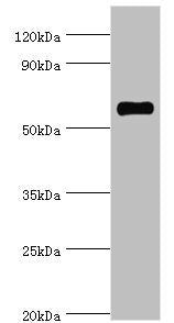 Western blot  | All lanes: SRSF4 antibody at 4µg/ml + Hela whole cell lysate  | Secondary  | Goat polyclonal to rabbit IgG at 1/10000 dilution  | Predicted band size: 57 kDa  | Observed band size: 57 kDaRabbit anti-Human SRSF4 Polyclonal Antibody