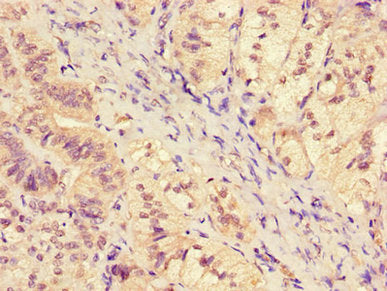 Immunohistochemistry of paraffin-embedded human adrenal gland tissue using SGK1 Antibody at dilution of 1:100Rabbit anti-Human SGK1 Polyclonal Antibody