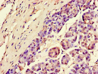 Immunohistochemistry of paraffin-embedded human pancreatic tissue using SGK1 Antibody at dilution of 1:100Rabbit anti-Human SGK1 Polyclonal Antibody