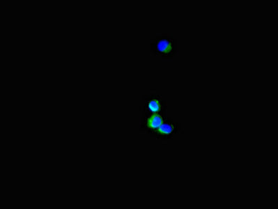Immunofluorescent analysis of Hela cells using SH3BP5 Antibody at dilution of 1:100 and Alexa Fluor 488-congugated AffiniPure Goat Anti-Rabbit IgG(H+L)Rabbit anti-Human SH3BP5 Polyclonal Antibody