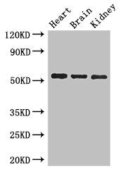 Western Blot | Positive WB detected in: Mouse heart tissue, Mouse brain tissue, Mouse kidney tissue | All lanes: SH3BP5 antibody at 3μg/ml | Secondary | Goat polyclonal to rabbit IgG at 1/50000 dilution | Predicted band size: 51, 33 kDa | Observed band size: 51 kDaRabbit anti-Human SH3BP5 Polyclonal Antibody