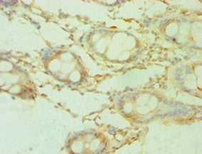 Immunohistochemistry of paraffin-embedded human colon tissue using SHMT1 Antibody at dilution of 1:100Rabbit anti-Human SHMT1 Polyclonal Antibody