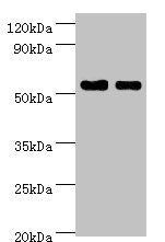 Western blot  | All lanes: SHMT1 antibody at 7µg/ml  | Lane 1: Hela whole cell lysate  | Lane 2: HepG2 whole cell lysate  | Secondary  | Goat polyclonal to rabbit IgG at 1/10000 dilution  | Predicted band size: 54, 50, 45, 38 kDa  | Observed band size: 54 kDaRabbit anti-Human SHMT1 Polyclonal Antibody