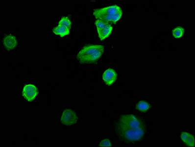 Immunofluorescence staining of MCF-7 cells with SIAH2 Antibody at 1:200, counter-stained with DAPI. The cells were fixed in 4% formaldehyde, permeabilized using 0.2% Triton X-100 and blocked in 10% normal Goat Serum. The cells were then incubated with the antibody overnight at 4°C. The secondary antibody was Alexa Fluor 488-congugated AffiniPure Goat Anti-Rabbit IgG(H+L).Rabbit anti-Human SIAH2 Polyclonal Antibody