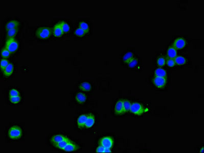 Immunofluorescent analysis of HepG2 cells using SIK1 Antibody at dilution of 1:100 and Alexa Fluor 488-congugated AffiniPure Goat Anti-Rabbit IgG(H+L)Rabbit anti-Human SIK1 Polyclonal Antibody
