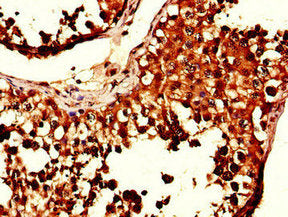 Immunohistochemistry of paraffin-embedded human testis tissue using SIK1 Antibody at dilution of 1:100Rabbit anti-Human SIK1 Polyclonal Antibody