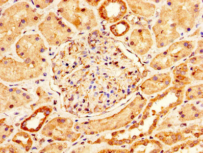 IHC image of PMEL Antibody diluted at 1:200 and staining in paraffin-embedded human kidney tissue performed on a Leica BondTM system. After dewaxing and hydration, antigen retrieval was mediated by high pressure in a citrate buffer (pH 6.0). Section was blocked with 10% normal goat serum 30min at RT. Then primary antibody (1% BSA) was incubated at 4°C overnight. The primary is detected by a biotinylated secondary antibody and visualized using an HRP conjugated SP system.Rabbit anti-Human PMEL Polyclonal Antibody