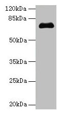 Western blot  | All lanes: PMEL antibody at 14µg/ml + Jurkat whole cell lysate  | Secondary  | Goat polyclonal to rabbit IgG at 1/10000 dilution  | Predicted band size: 71, 61, 67 kDa  | Observed band size: 71 kDa