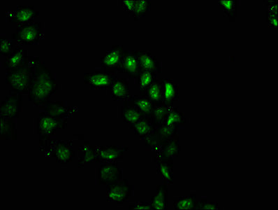 Immunofluorescence staining of Hela cells with GEMIN2 Antibody at 1:100, counter-stained with DAPI. The cells were fixed in 4% formaldehyde, permeabilized using 0.2% Triton X-100 and blocked in 10% normal Goat Serum. The cells were then incubated with the antibody overnight at 4°C. The secondary antibody was Alexa Fluor 488-congugated AffiniPure Goat Anti-Rabbit IgG(H+L).Rabbit anti-Human GEMIN2 Polyclonal Antibody