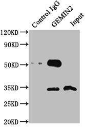 Immunoprecipitating GEMIN2 in 293T whole cell lysate  | Lane 1: Rabbit control IgG instead of GEMIN2 Antibody in 293T whole cell lysate. For western blotting, a HRP-conjugated Protein G antibody was used as the secondary antibody (1/50000)  | Lane 2: GEMIN2 Antibody (6μg) + 293T whole cell lysate (0.5mg)  | Lane 3: 293T whole cell lysate (20μg)Rabbit anti-Human GEMIN2 Polyclonal Antibody