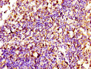 Immunohistochemistry of paraffin-embedded human tonsil tissue using SIPA1 Antibody at dilution of 1:100Rabbit anti-Human SIPA1 Polyclonal Antibody