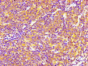 Immunohistochemistry of paraffin-embedded human lymph node tissue using SIPA1 Antibody at dilution of 1:100Rabbit anti-Human SIPA1 Polyclonal Antibody