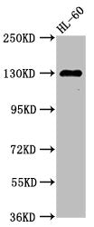 Western Blot  | Positive WB detected in: HL60 whole cell lysate  | All lanes: SIPA1 antibody at 2.7μg/ml  | Secondary  | Goat polyclonal to rabbit IgG at 1/50000 dilution  | Predicted band size: 112 kDa  | Observed band size: 130 kDaRabbit anti-Human SIPA1 Polyclonal Antibody
