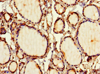 Immunohistochemistry of paraffin-embedded human thyroid tissue using the antibody at dilution of 1:100Rabbit anti-Human SIRPB1 Polyclonal Antibody