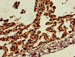 Immunohistochemistry of paraffin-embedded human lung tissue using SKIL Antibody at dilution of 1:100Rabbit anti-Human SKIL Polyclonal Antibody