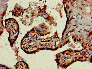 Immunohistochemistry of paraffin-embedded human placenta tissue using SKIL Antibody at dilution of 1:100Rabbit anti-Human SKIL Polyclonal Antibody