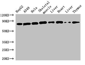 Western Blot  | Positive WB detected in: HepG2 whole cell lysate, A549 whole cell lysate, Hela whole cell lysate, Mouse skeletal muscle tissue, Mouse liver tissue, Rat heart tissue, Rat liver tissue, Rat thymus tissue  | All lanes: SKIL antibody at 1.6µg/ml  | Secondary  | Goat polyclonal to rabbit IgG at 1/50000 dilution  | Predicted band size: 77, 47, 72, 45, 75 kDa  | Observed band size: 77 kDaRabbit anti-Human SKIL Polyclonal Antibody
