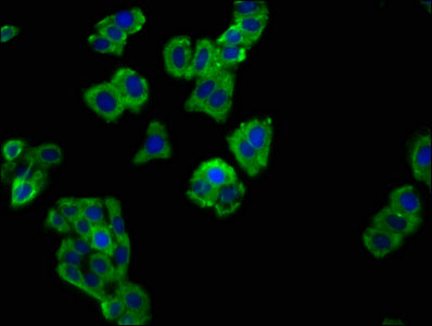 Immunofluorescence staining of HepG2 cells with SLAMF6 Antibody at 1:66, counter-stained with DAPI. The cells were fixed in 4% formaldehyde, permeabilized using 0.2% Triton X-100 and blocked in 10% normal Goat Serum. The cells were then incubated with the antibody overnight at 4°C. The secondary antibody was Alexa Fluor 488-congugated AffiniPure Goat Anti-Rabbit IgG(H+L).Rabbit anti-Human SLAMF6 Polyclonal Antibody