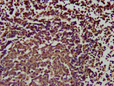IHC image of SLAMF6 Antibody diluted at 1:200 and staining in paraffin-embedded human lymph node tissue performed on a Leica BondTM system. After dewaxing and hydration, antigen retrieval was mediated by high pressure in a citrate buffer (pH 6.0). Section was blocked with 10% normal goat serum 30min at RT. Then primary antibody (1% BSA) was incubated at 4°C overnight. The primary is detected by a biotinylated secondary antibody and visualized using an HRP conjugated SP system.Rabbit anti-Human SLAMF6 Polyclonal Antibody