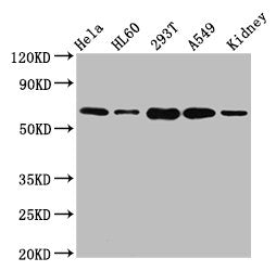 Western Blot | Positive WB detected in: Hela whole cell lysate, HL60 whole cell lysate, 293T whole cell lysate, A549 whole cell lysate, Mouse kidney tissue | All lanes: SLAMF6 antibody at 5.1μg/ml | Secondary | Goat polyclonal to rabbit IgG at 1/50000 dilution | Predicted band size: 38, 25 kDa | Observed band size: 60 kDaRabbit anti-Human SLAMF6 Polyclonal Antibody