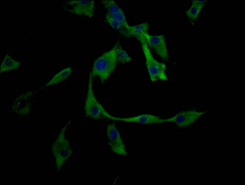 Immunofluorescence staining of U87 cell with SLAMF7 Antibody at 1:50, counter-stained with DAPI. The cells were fixed in 4% formaldehyde and blocked in 10% normal Goat Serum. The cells were then incubated with the antibody overnight at 4C. The secondary antibody was Alexa Fluor 488-congugated AffiniPure Goat Anti-Rabbit IgG(H+L).Rabbit anti-Human SLAMF7 Polyclonal Antibody