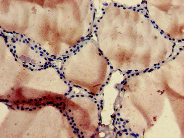 Immunohistochemistry of paraffin-embedded human thyroid tissue using SLC10A3 Antibody at dilution of 1:100Rabbit anti-Human SLC10A3 Polyclonal Antibody
