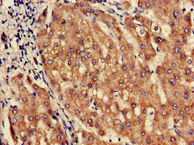 Immunohistochemistry of paraffin-embedded human liver tissue using SLC10A3 Antibody at dilution of 1:100Rabbit anti-Human SLC10A3 Polyclonal Antibody