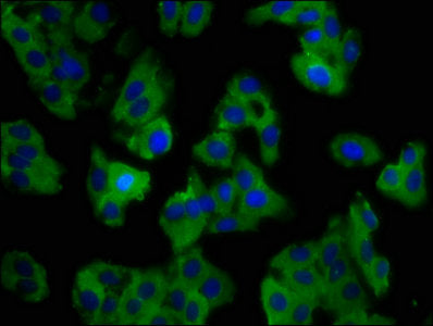Immunofluorescence staining of HepG2 cells with SLC11A1 Antibody at 1:100, counter-stained with DAPI. The cells were fixed in 4% formaldehyde, permeabilized using 0.2% Triton X-100 and blocked in 10% normal Goat Serum. The cells were then incubated with the antibody overnight at 4°C. The secondary antibody was Alexa Fluor 488-congugated AffiniPure Goat Anti-Rabbit IgG(H+L).Rabbit anti-Human SLC11A1 Polyclonal Antibody