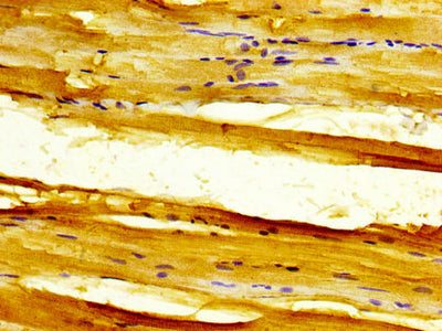 IHC image of SLC11A1 Antibody diluted at 1:300 and staining in paraffin-embedded human skeletal muscle tissue performed on a Leica BondTM system. After dewaxing and hydration, antigen retrieval was mediated by high pressure in a citrate buffer (pH 6.0). Section was blocked with 10% normal goat serum 30min at RT. Then primary antibody (1% BSA) was incubated at 4°C overnight. The primary is detected by a biotinylated secondary antibody and visualized using an HRP conjugated SP system.Rabbit anti-Human SLC11A1 Polyclonal Antibody