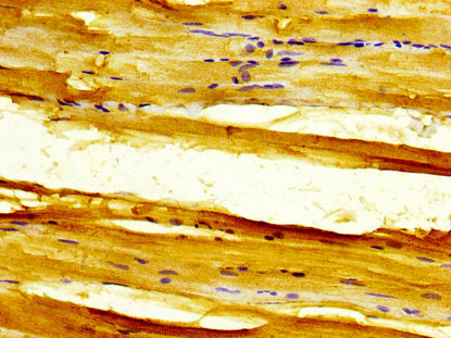 IHC image of SLC11A1 Antibody diluted at 1:300 and staining in paraffin-embedded human skeletal muscle tissue performed on a Leica BondTM system. After dewaxing and hydration, antigen retrieval was mediated by high pressure in a citrate buffer (pH 6.0). Section was blocked with 10% normal goat serum 30min at RT. Then primary antibody (1% BSA) was incubated at 4°C overnight. The primary is detected by a biotinylated secondary antibody and visualized using an HRP conjugated SP system.Rabbit anti-Human SLC11A1 Polyclonal Antibody