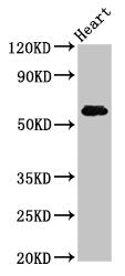 Western Blot | Positive WB detected in: Rat heart tissue | All lanes: SLC11A1 antibody at 5μg/ml | Secondary | Goat polyclonal to rabbit IgG at 1/50000 dilution | Predicted band size: 60, 48 kDa | Observed band size: 60 kDaRabbit anti-Human SLC11A1 Polyclonal Antibody