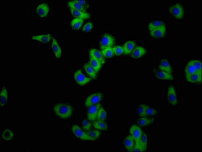 Immunofluorescence staining of HepG2 cells with SLC11A2 Antibody at 1:100, counter-stained with DAPI. The cells were fixed in 4% formaldehyde, permeabilized using 0.2% Triton X-100 and blocked in 10% normal Goat Serum. The cells were then incubated with the antibody overnight at 4°C. The secondary antibody was Alexa Fluor 488-congugated AffiniPure Goat Anti-Rabbit IgG(H+L).Rabbit anti-Human SLC11A2 Polyclonal Antibody