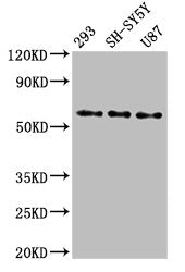 Western Blot | Positive WB detected in: 293 whole cell lysate, SH-SY5Y whole cell lysate, U87 whole cell lysate | All lanes: SLC11A2 antibody at 3μg/ml | Secondary | Goat polyclonal to rabbit IgG at 1/50000 dilution | Predicted band size: 63, 62, 65, 66 kDa | Observed band size: 63 kDaRabbit anti-Human SLC11A2 Polyclonal Antibody