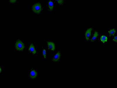 Immunofluorescence staining of Hela cell with SLC12A2 Antibody at 1:30, counter-stained with DAPI. The cells were fixed in 4% formaldehyde and blocked in 10% normal Goat Serum. The cells were then incubated with the antibody overnight at 4C. The secondary antibody was Alexa Fluor 488-congugated AffiniPure Goat Anti-Rabbit IgG(H+L).Rabbit anti-Human SLC12A2 Polyclonal Antibody