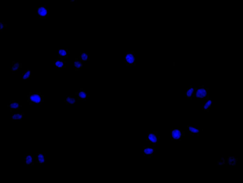 Immunofluorescence staining of Hela cell with 5% goat serum, counter-stained with DAPI. The cells were fixed in 4% formaldehyde and blocked in 10% normal Goat Serum. The cells were then incubated with the antibody overnight at 4C. The secondary antibody was Alexa Fluor 488-congugated AffiniPure Goat Anti-Rabbit IgG(H+L).Rabbit anti-Human SLC12A2 Polyclonal Antibody
