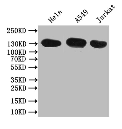 Western Blot Positive WB detected in: Hela whole cell lysate,A549 whole cell lysate,JK whole cell lysate All lanes: SLC12A2 antibody at 1:1000 Secondary Goat polyclonal to rabbit IgG at 1/50000 dilution Predicted band size: 132 kDa Observed band size: 132 kDaRabbit anti-Human SLC12A2 Polyclonal Antibody