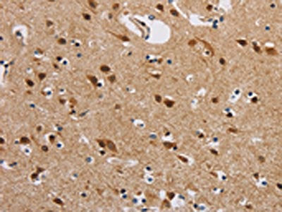 The image on the left is immunohistochemistry of paraffin-embedded Human brain  tissue using IL19 Antibody(IL19 Antibody) at dilution 1/40, on the right is treated with synthetic peptide. (Original magnification: ×200)