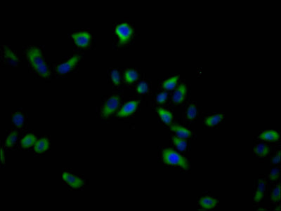 Immunofluorescence staining of Hela cells with SLC16A7 Antibody at 1:200, counter-stained with DAPI. The cells were blocked in 10% normal Goat Serum and incubated with the antibody overnight at 4°C. Nuclear DNA was labeled in blue with DAPI. The secondary antibody was Alexa Fluor 488-congugated AffiniPure Goat Anti-Rabbit IgG(H+L).Rabbit anti-Human SLC16A7 Polyclonal Antibody