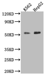 Western Blot | Positive WB detected in: K-562 whole cell lysate, HepG2 whole cell lysate | All lanes: SLC16A7 antibody at 1:2000 | Secondary | Goat polyclonal to rabbit IgG at 1/50000 dilution | Predicted band size: 53 kDa | Observed band size: 53 kDaRabbit anti-Human SLC16A7 Polyclonal Antibody