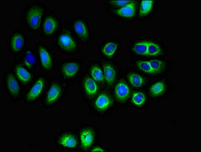 Immunofluorescent analysis of A549 cells using SLC16A8 Antibody at dilution of 1:100 and Alexa Fluor 488-congugated AffiniPure Goat Anti-Rabbit IgG(H+L)Rabbit anti-Human SLC16A8 Polyclonal Antibody