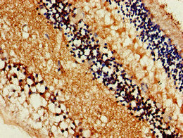 Immunohistochemistry of paraffin-embedded human eye tissue using SLC16A8 Antibody at dilution of 1:100Rabbit anti-Human SLC16A8 Polyclonal Antibody