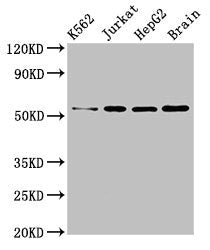 Western Blot  | Positive WB detected in: K562 whole cell lysate, Jurkat whole cell lysate, HepG2 whole cell lysate, Mouse brain tissue  | All lanes: SLC16A8 antibody at 3µg/ml  | Secondary  | Goat polyclonal to rabbit IgG at 1/50000 dilution  | Predicted band size: 53 kDa  | Observed band size: 53 kDaRabbit anti-Human SLC16A8 Polyclonal Antibody