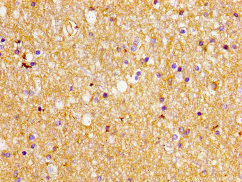 Immunohistochemistry of paraffin-embedded human brain tissue using SLC1A2 Antibody at dilution of 1:100Rabbit anti-Human SLC1A2 Polyclonal Antibody