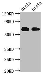 Western Blot | Positive WB detected in: Rat brain tissue, Mouse brain tissue | All lanes: SLC1A2 antibody at 3.2μg/ml | Secondary | Goat polyclonal to rabbit IgG at 1/50000 dilution | Predicted band size: 63, 62 kDa | Observed band size: 63 kDaRabbit anti-Human SLC1A2 Polyclonal Antibody
