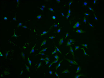 Immunofluorescence staining of U251 cells with SLC1A3 Antibody at 1:100, counter-stained with DAPI. The cells were fixed in 4% formaldehyde and blocked in 10% normal Goat Serum. The cells were then incubated with the antibody overnight at 4°C. The secondary antibody was Alexa Fluor 488-congugated AffiniPure Goat Anti-Rabbit IgG(H+L).Rabbit anti-Human SLC1A3 Polyclonal Antibody