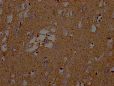 IHC image of SLC1A3 Antibody diluted at 1:200 and staining in paraffin-embedded human brain tissue performed on a Leica BondTM system. After dewaxing and hydration, antigen retrieval was mediated by high pressure in a citrate buffer (pH 6.0). Section was blocked with 10% normal goat serum 30min at RT. Then primary antibody (1% BSA) was incubated at 4°C overnight. The primary is detected by a Goat anti-rabbit polymer IgG labeled by HRP and visualized using 0.05% DAB.Rabbit anti-Human SLC1A3 Polyclonal Antibody