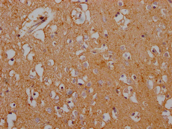 IHC image of SLC1A3 Antibody diluted at 1:200 and staining in paraffin-embedded human brain tissue performed on a Leica BondTM system. After dewaxing and hydration, antigen retrieval was mediated by high pressure in a citrate buffer (pH 6.0). Section was blocked with 10% normal goat serum 30min at RT. Then primary antibody (1% BSA) was incubated at 4°C overnight. The primary is detected by a Goat anti-rabbit polymer IgG labeled by HRP and visualized using 0.05% DAB.Rabbit anti-Human SLC1A3 Polyclonal Antibody