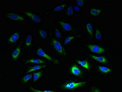 Immunofluorescent analysis of Hela cells using SLC1A6 Antibody at dilution of 1:100 and Alexa Fluor 488-congugated AffiniPure Goat Anti-Rabbit IgG(H+L)Rabbit anti-Human SLC1A6 Polyclonal Antibody